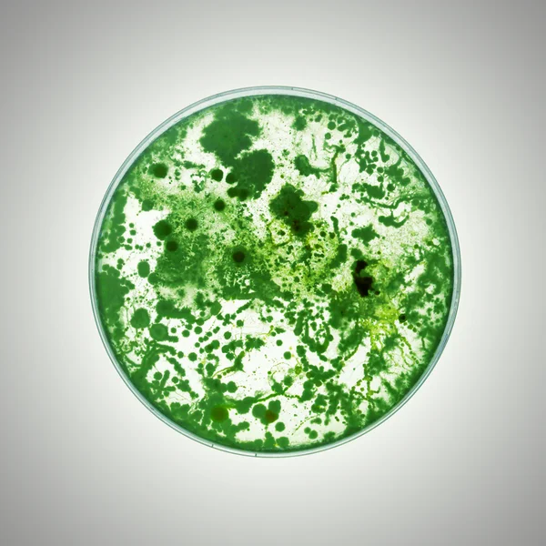 Petri kabında büyüyen bakteriler. — Stok fotoğraf