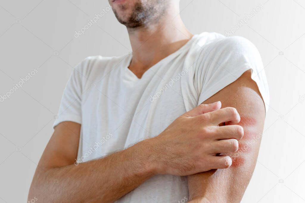 young man scratches his hand