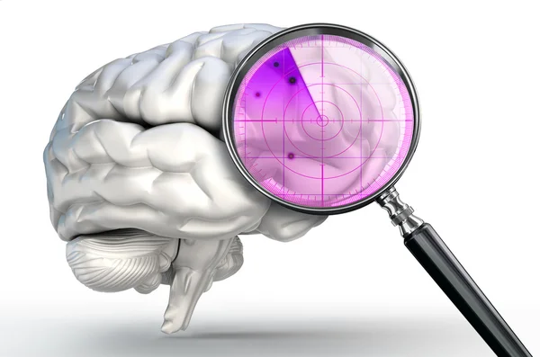 Scan on human brain with magnifying glass radar — Stock Photo, Image