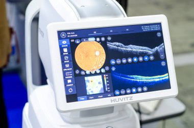 Kyiv, Ukrayna - 08 Ekim 2020: Huvitz HOCT-1 / 1F ile anjiyografi