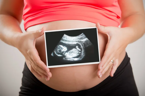 Frau mit Ultraschall — Stockfoto