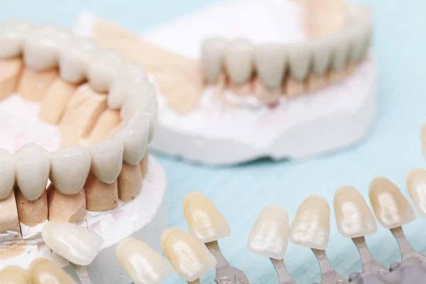 Protezy dentystyczne z bliska — Zdjęcie stockowe