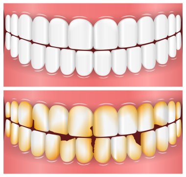 Teeth, Mouth, Dentistry clipart
