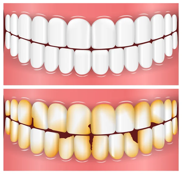 Dents, bouche, dentisterie — Image vectorielle