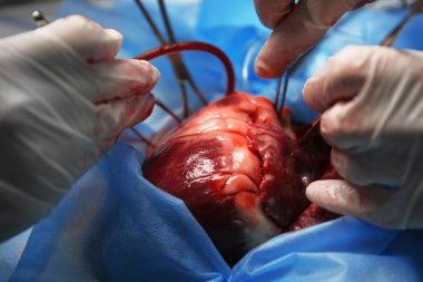 Doktor kalp işlem yapmadan
