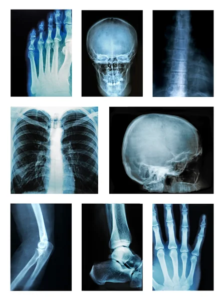 Collage di molte radiografie — Foto Stock