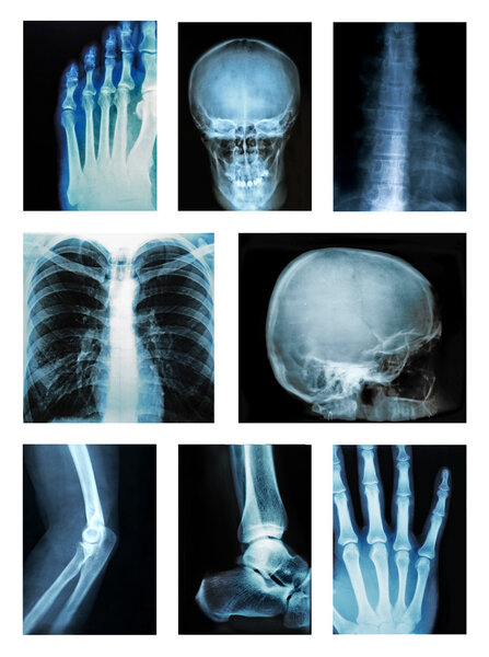 Коллаж многих рентгеновских лучей
