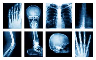 Birçok x-ışınları kolaj