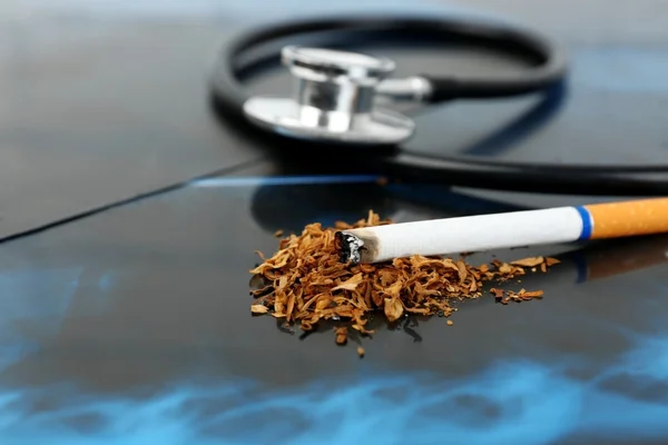 Cigarett och stetoskop på röntgen lung — Stockfoto