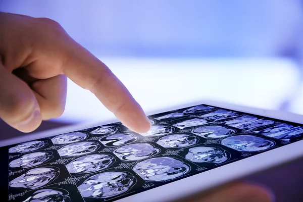 Médico mano tocando tableta digital moderna, de cerca — Foto de Stock