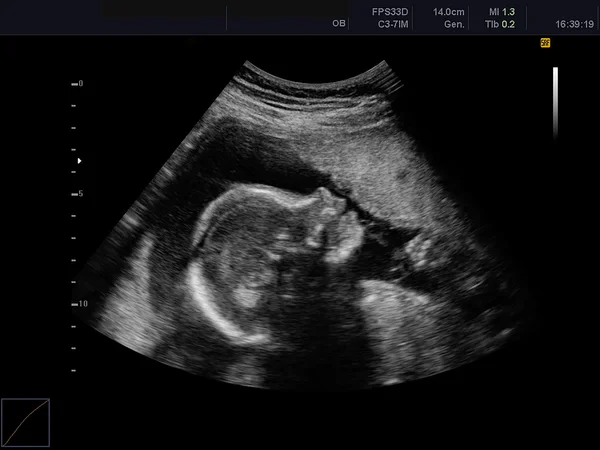 Bebeğin ultrason taraması — Stok fotoğraf