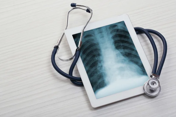Zdjęcia rentgenowskie na ekranie tabletu — Zdjęcie stockowe