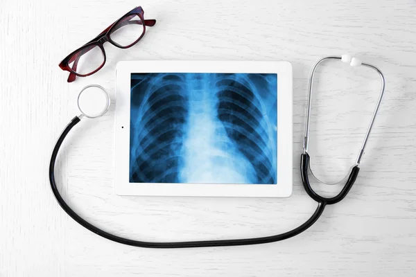 Radiografía en pantalla de tableta con estetoscopio — Foto de Stock