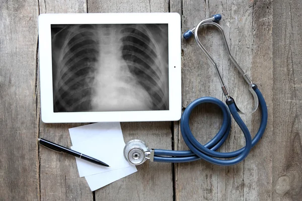 Radiographie sur écran de tablette avec stéthoscope — Photo