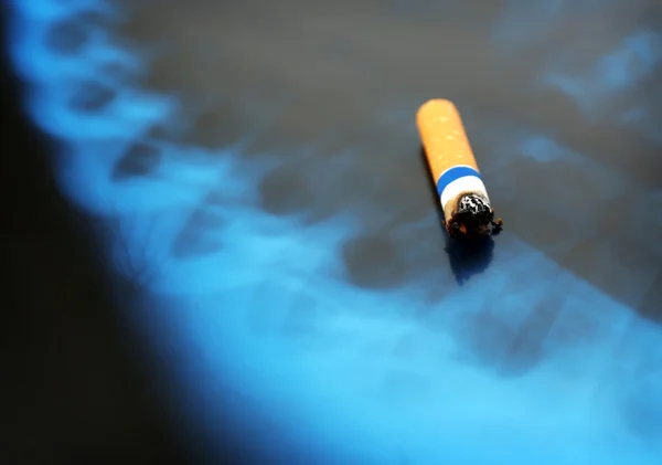 Cigaretu na RTG plic — Stock fotografie