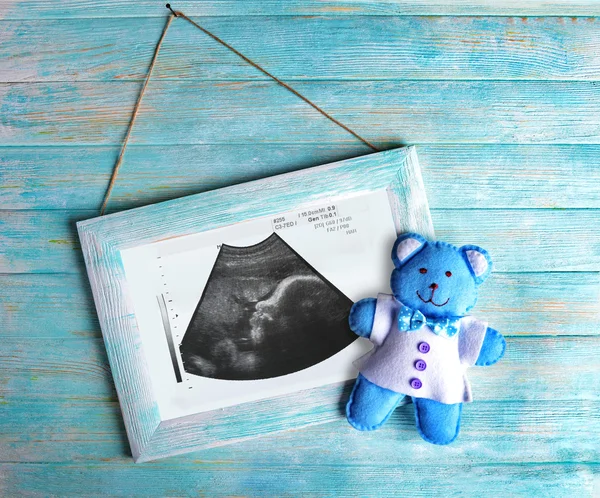 Bebeğin ultrason inceden inceye gözden geçirmek ile çerçeve — Stok fotoğraf
