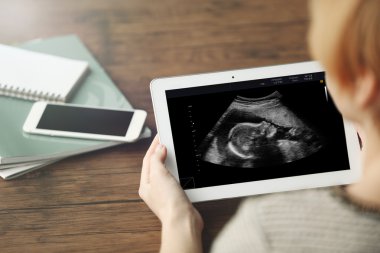  Bebeğin ultrason inceden inceye gözden geçirmek ile dijital tablet