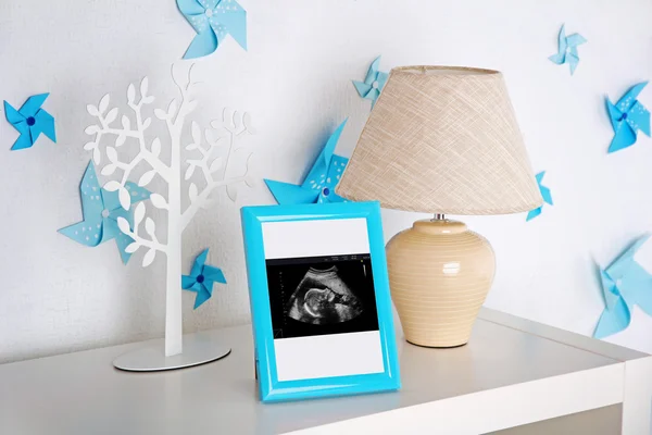 Moldura com ultra-som do bebê — Fotografia de Stock