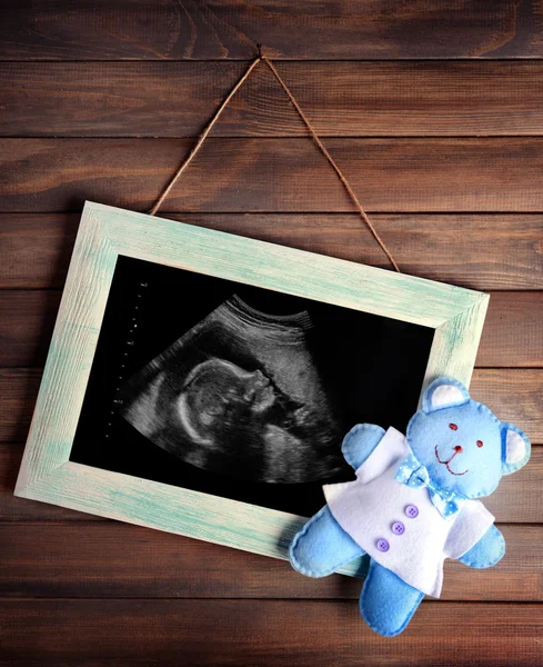 Ultraschalluntersuchung von Baby — Stockfoto