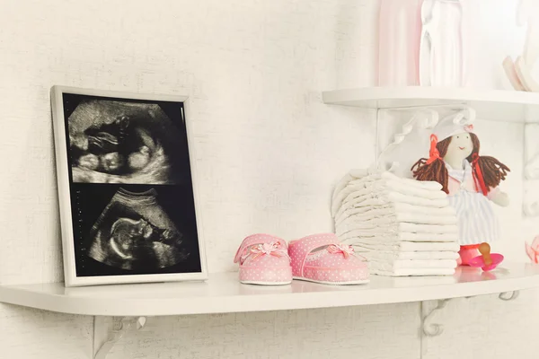 Fotorahmen mit Ultraschall des Babys — Stockfoto