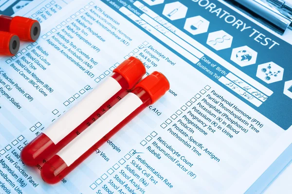 Blood samples on  report — Stock Photo, Image