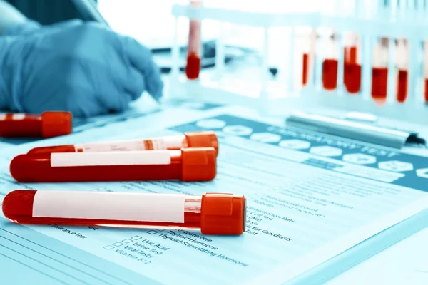 Blood samples and doctor hands — Stock Photo, Image