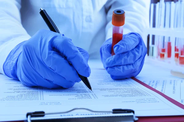 Doctor hands with blood sample — Stock Photo, Image