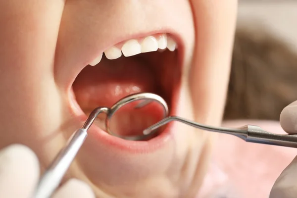 Dentista examinando os dentes da menina, close-up — Fotografia de Stock