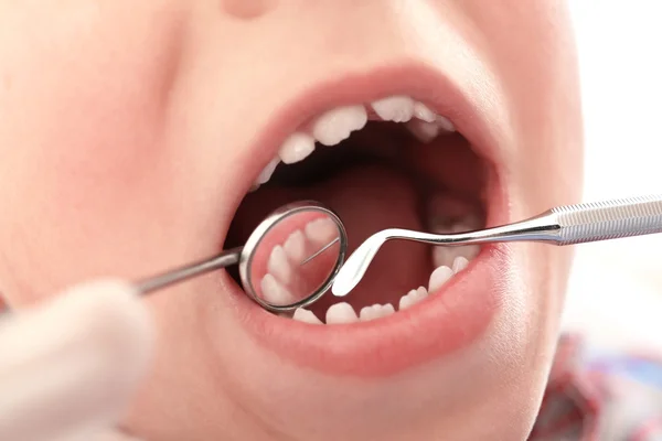 Dentista Examinando Los Dientes Del Niño Cerca — Foto de Stock