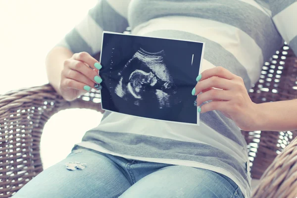 Schwangere mit dem Ultraschall-Foto — Stockfoto