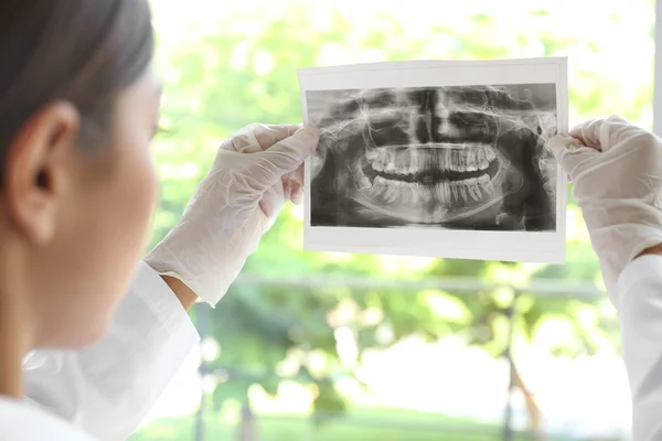 Zahnarzt Betrachtet Zahnröntgenographie — Stockfoto