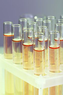 gri zemin üzerine sıvı ile test tüpleri