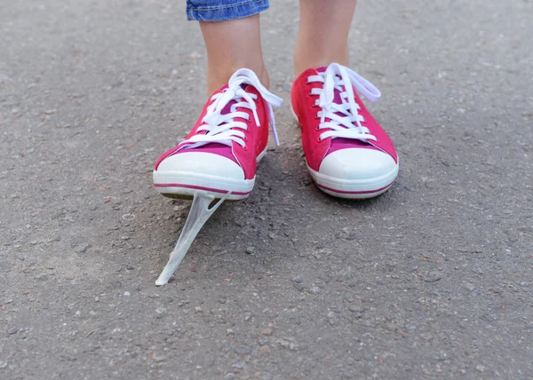 Foot stuck into chewing gum — Stock Photo, Image