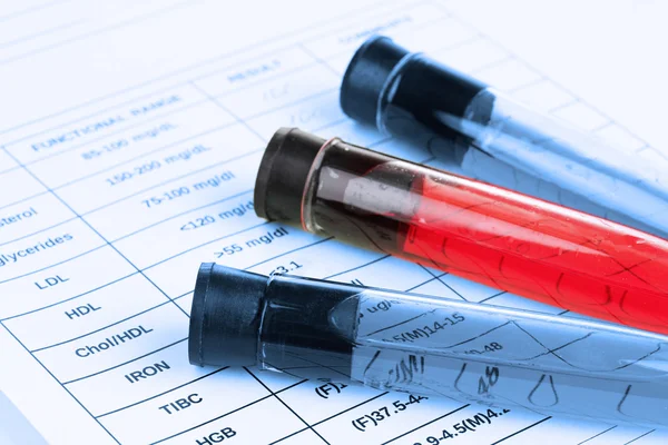 Blood in test tubes — Stock Photo, Image