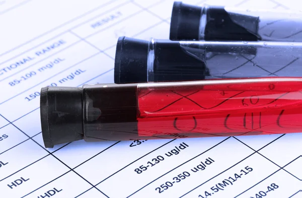 Blood in test tubes — Stock Photo, Image