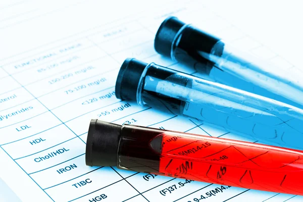 Blood in test tubes and results close up — Stock Photo, Image