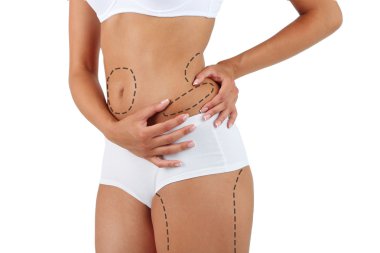 Plastik cerrahi. Liposuction. İnce gövde kavramı