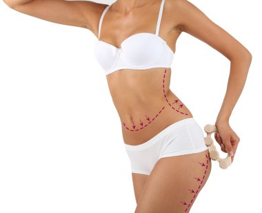 Plastik cerrahi. Liposuction.