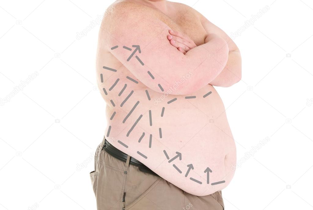 Fat man marked with lines