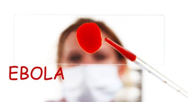 Ebola virüs hastalık