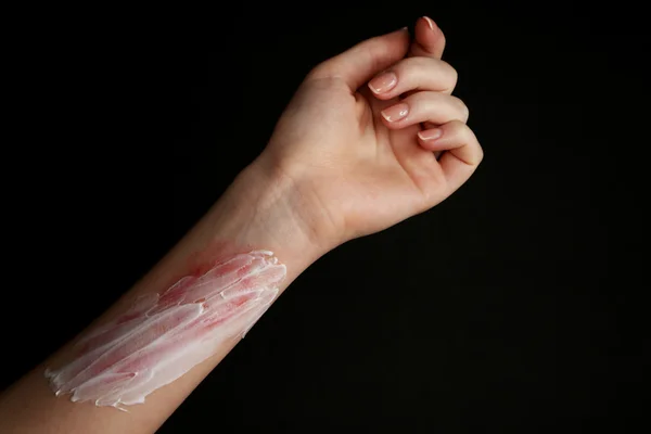 Treatment of burns on female hand on black background — Stock Photo, Image