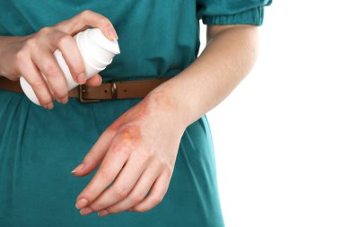Treatment of burns by spray on female hand isolated on white clipart