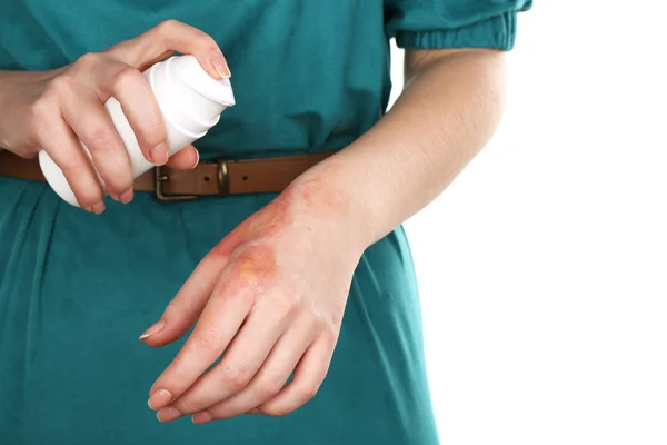 Leczenie oparzeń przez spray kobiece strony na białym tle — Zdjęcie stockowe