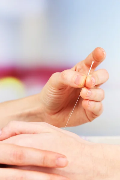 Acupuncture à portée de main, fermer. Isolé sur blanc — Photo