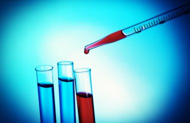 Pipet kırmızı sıvı test tüpleri parlak arka plan üzerinde bir ekleme