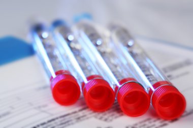 Test tüpleri ve Pano ile tıbbi geçmişi formu kapat