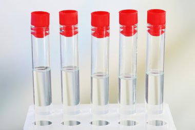 Test tüpleri açık renkli üzerinde