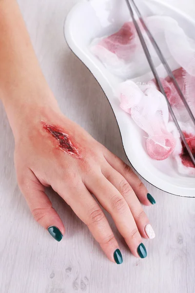 Verletzte Hand mit Blut — Stockfoto