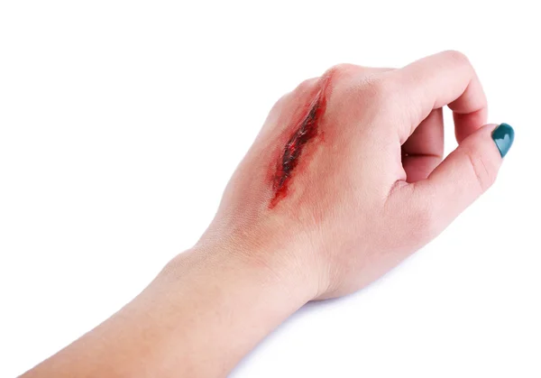 Gewonde hand met bloed — Stockfoto
