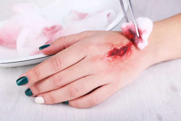 Injured hand with blood — Stock Photo, Image